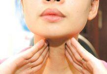 bệnh bướu cổ basedown