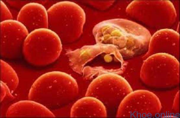 Bệnh Thalassemia là gì ?
