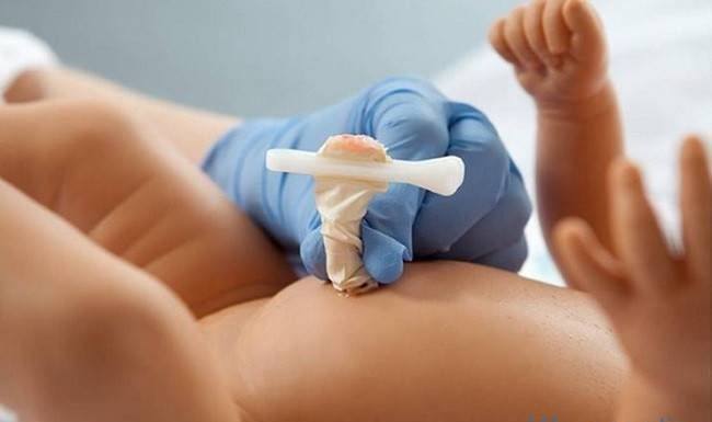 nhiễm trùng rốn ở trẻ sơ sinh
