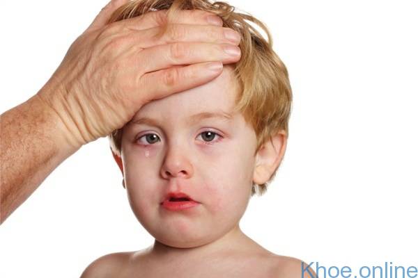 Trẻ có thể bị sốt nhẹ sau khi tiêm phòng quai bị