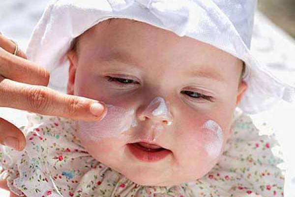 Trẻ bị chàm Eczema 
