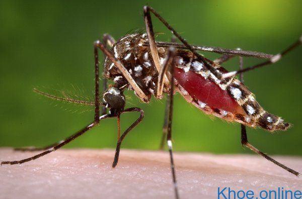 Dấu hiệu nhận biết nhiễm virus Zika