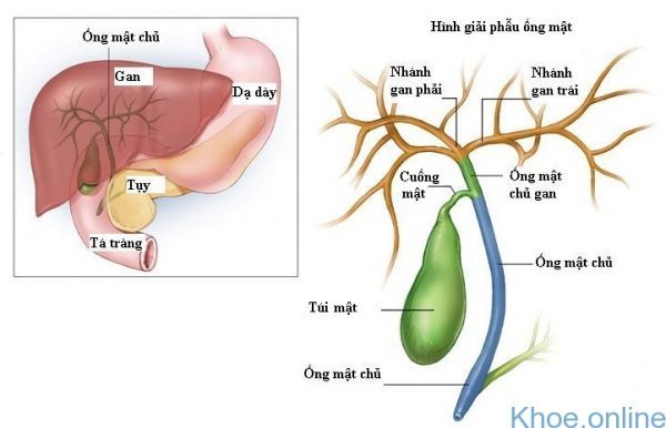 ung thư đường mật