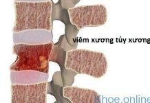 viêm tủy xương