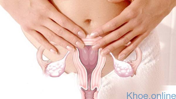 Xói mòn cổ tử cung là do viêm cổ tử cung mãn tính kéo dài gây ra