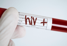 văcxin điều trị HIV