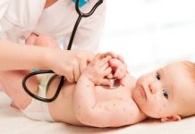 biến chứng của bệnh thủy đậu