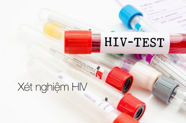 Xét nghiệm HIV mất bao nhiêu tiền?