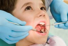 Bệnh răng miệng và mách bạn cách điều trị hiệu quả