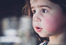 Lupus ban đỏ có lây không?