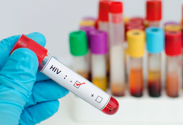 Phát hiện 3.600 người nhiễm HIV