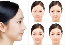 Phẫu thuật thẩm mỹ mũi