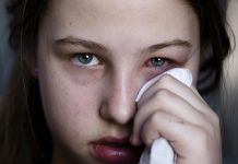 Dịch đau mắt đỏ có dấu hiệu vào mùa