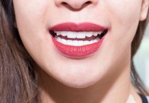 Nhiều người bệnh bị viêm lợi, tụt lợi, có kẽ chỉ đen ở chân răng sau khi làm răng sứ