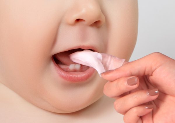 Có nên khám răng định kỳ cho trẻ không?