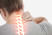 thoái hóa cột sống cổ