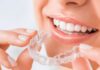 niềng răng invisalign