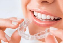 niềng răng invisalign