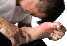 Cơn đau xương khớp do bệnh gút chủ yếu tập trung ở các khớp nhỏ như khớp ngón chân.