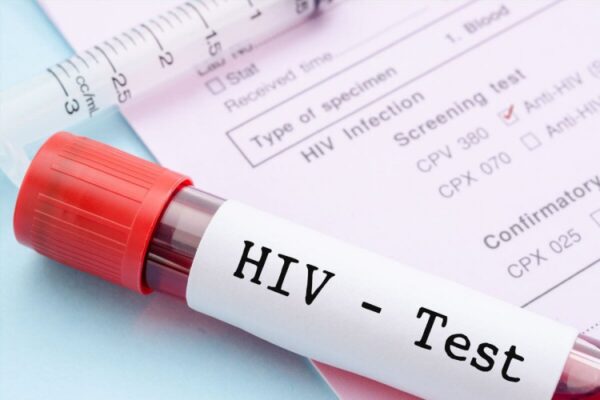 xét nghiệm hiv ở đâu