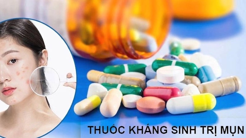 Thuốc kháng sinh trị mụn trứng cá