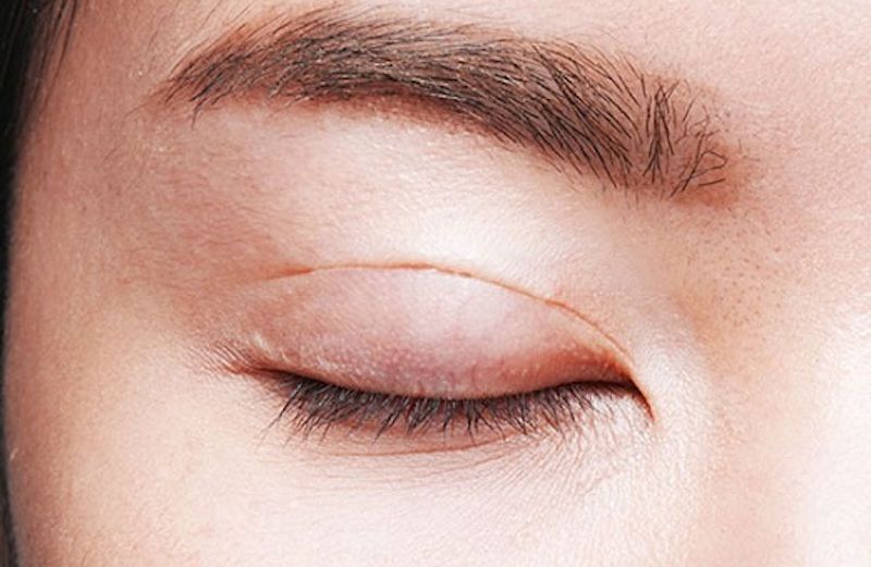 nhấn mí hỏng có sửa được không