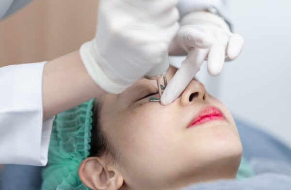 Chi phí cắt bọng mắt dưới