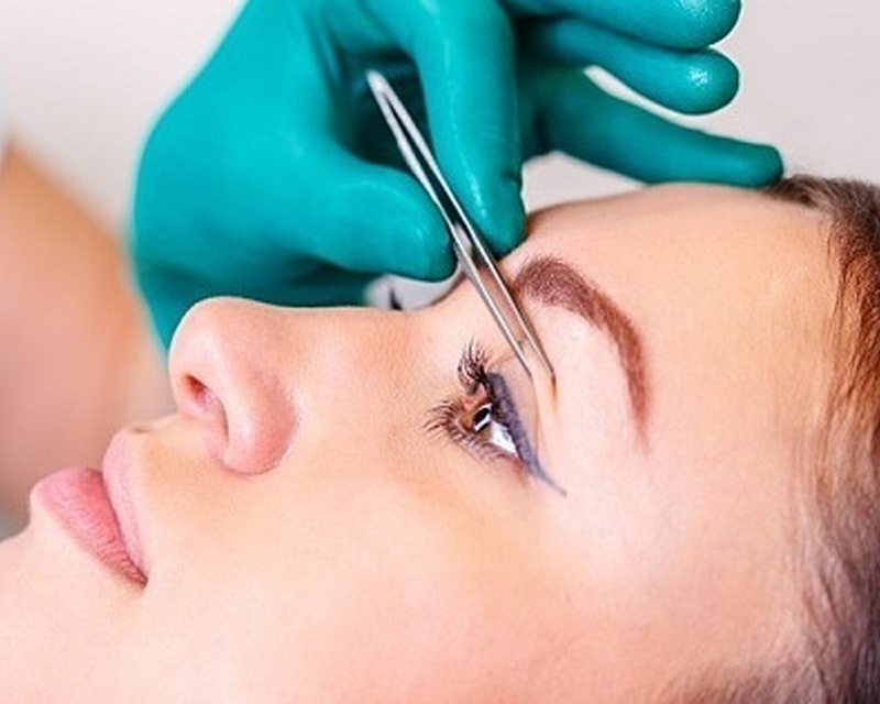 Cách khắc phục nhấn mí bị lộ chỉ nhiều