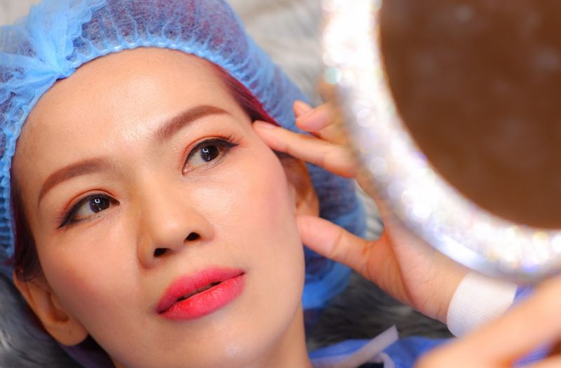 Nhấn mí có cần cắt chỉ không