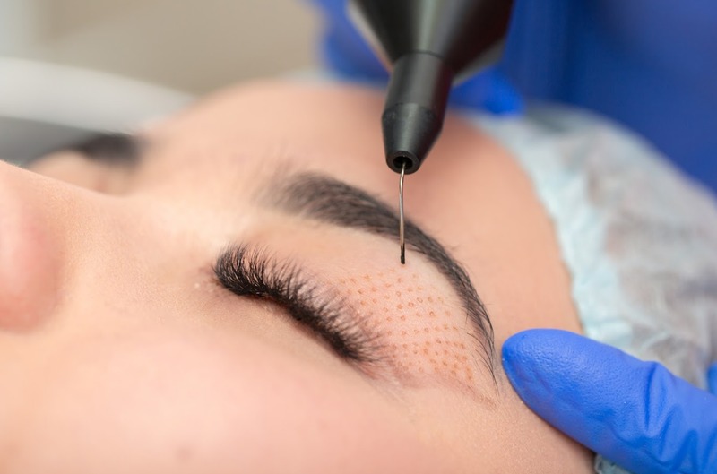 Nhấn mí plasma giữ được bao lâu